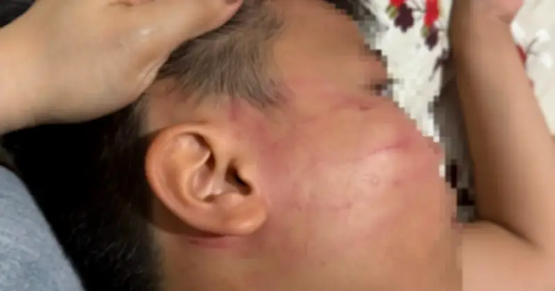 Mẹ tố con trai bị thầy giáo Ấn Độ tát sưng mặt khi học thêm