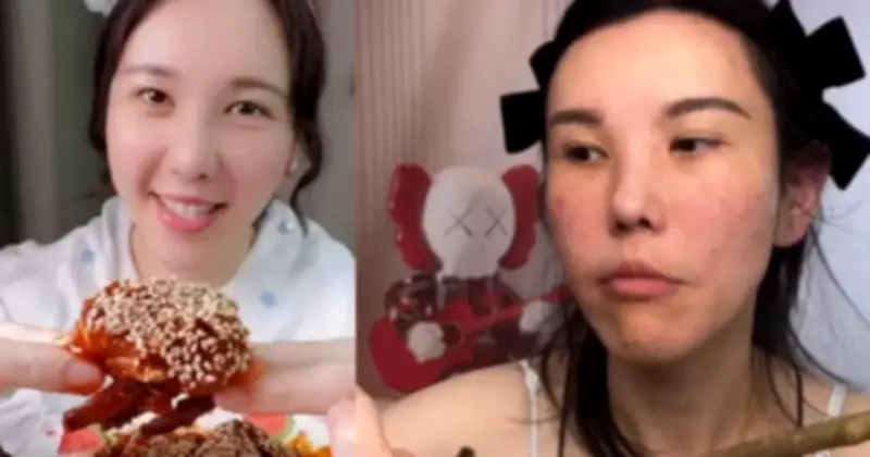 Mặt cô gái trẻ biến dạng sau 2 năm làm mukbang, bác sĩ cảnh báo 4 cái giá sức khỏe ít ai biết