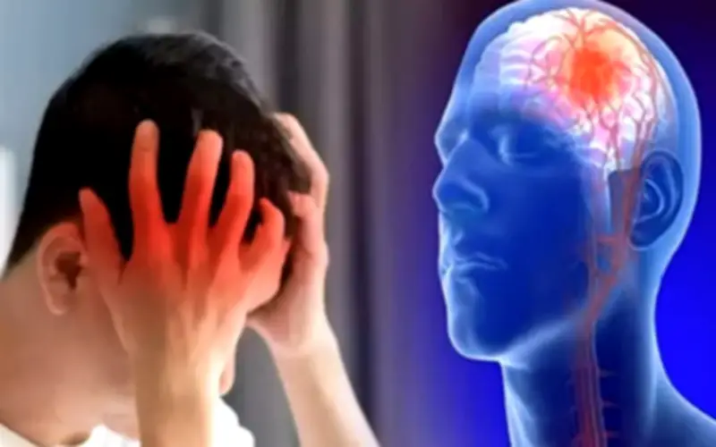 Người đàn ông 3 lần đột quỵ ở tuổi 40: Bác sĩ phát hiện nguyên nhân bất ngờ