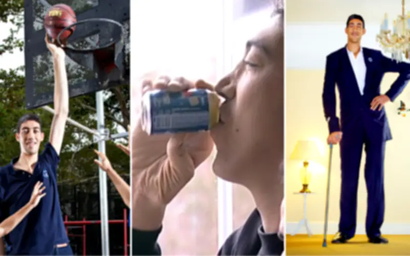 Người đàn ông cao nhất thế giới và căn bệnh hiếm gặp phía sau