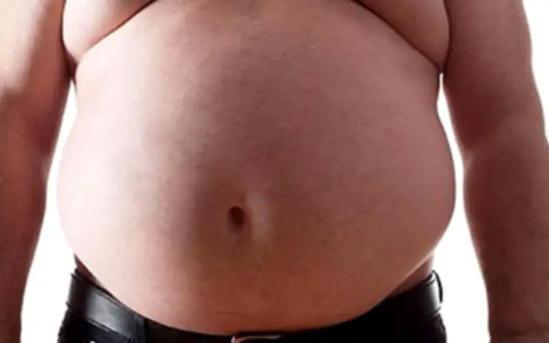 Người đàn ông tưởng mang thai 20 kg hóa ra là khối u
