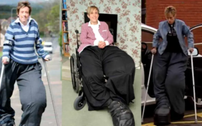 Người phụ nữ sở hữu đôi chân khổng lồ nặng gần 100kg: Hành trình vượt lên số phận