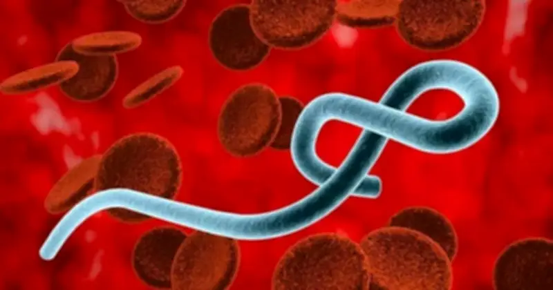 Nguy cơ Ebola xâm nhập Việt Nam qua đường du lịch quốc tế