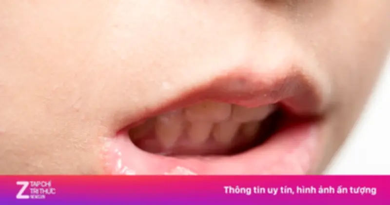 Nhiều người có hàm răng xấu mà không biết nguyên nhân từ đâu