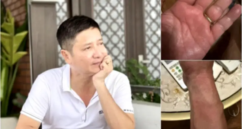 NSƯT Chí Trung mắc bệnh lạ mất ngủ triền miên