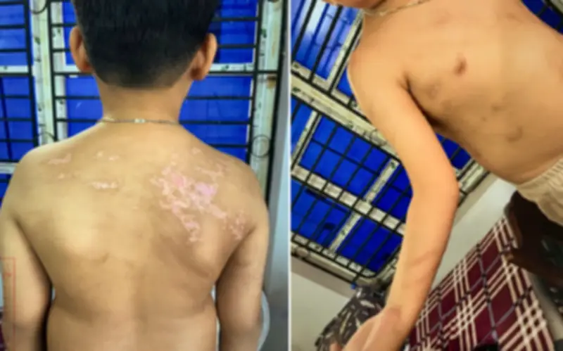 Phú Thọ: Khởi tố, bắt giam bố đẻ bạo hành con ruột gây thương tích