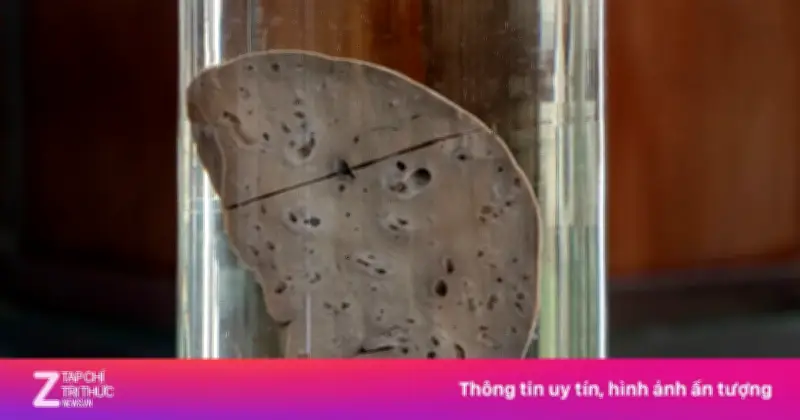 Sự thật về thuốc 'bổ gan' và 'thải độc gan': Chuyên gia cảnh báo
