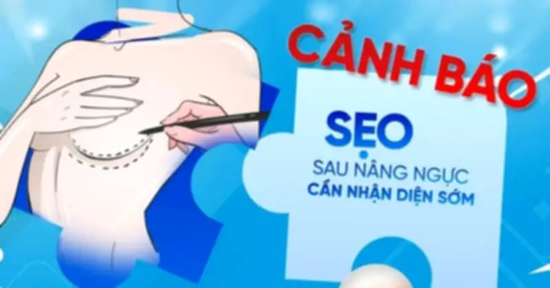 Sẹo sau phẫu thuật ngực: Nguyên nhân và giải pháp từ silicone y tế