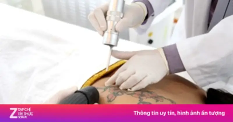 Thanh niên 18 tuổi co giật, hôn mê sâu sau khi bôi thuốc tê phun xăm
