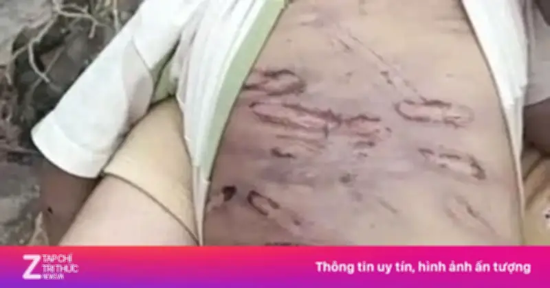 Tiếng kêu cứu từ mái ấm: Cần phát hiện sớm và can thiệp kịp thời bảo vệ trẻ em