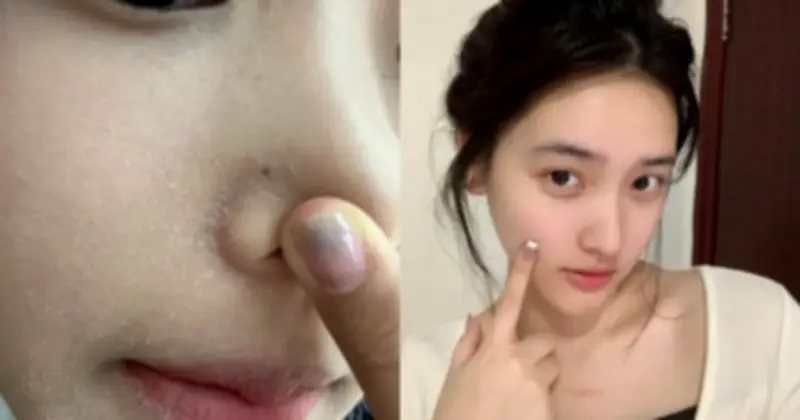 Top 5 serum dưỡng ẩm và chống lão hóa đáng mua nhất hiện nay