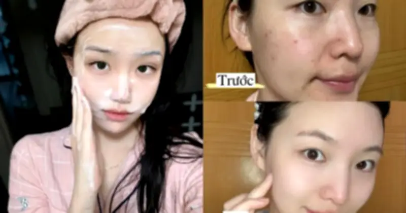 Top 6 sữa rửa mặt cho da dầu mụn: Làm sạch sâu, ngừa mụn hiệu quả