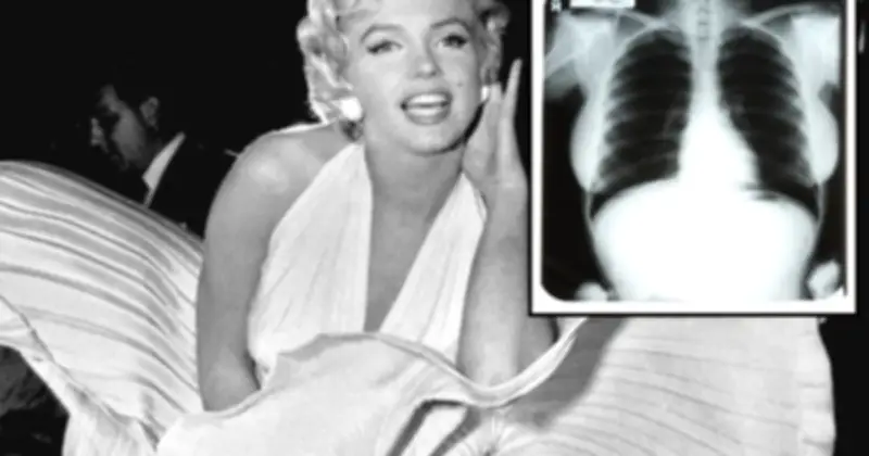 Đấu giá phim X-quang của Marilyn Monroe gây tranh cãi
