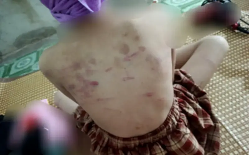 Vụ nữ sinh lớp 4 ở Cao Bằng bị đánh: Mẹ người dân tộc Nùng học hết lớp 7 mong con được bảo vệ