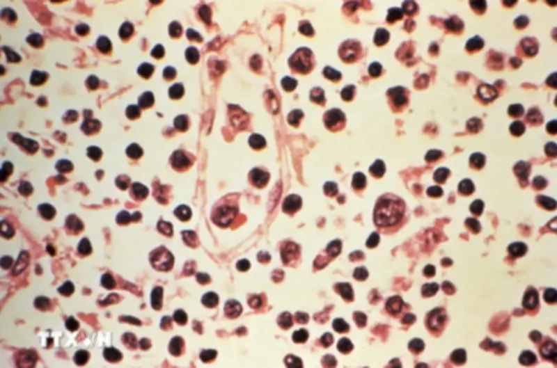 Việt Nam tăng cường kiểm dịch biên giới phòng virus Hanta