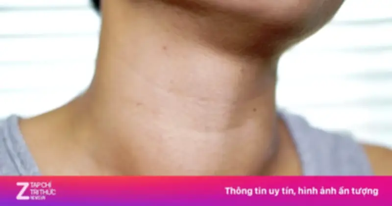Vòng cổ to bất thường cảnh báo nhiều bệnh nguy hiểm, cần đi khám ngay