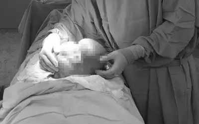 Bụng to bất thường, người phụ nữ phát hiện 50 khối u xơ nặng 3kg