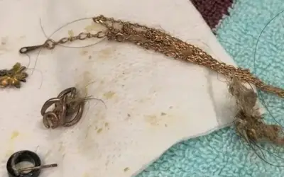 Chó hoang nuốt dây chuyền vàng 18k, bác sĩ thú y bất ngờ