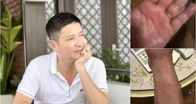 NSƯT Chí Trung mắc bệnh lạ mất ngủ triền miên