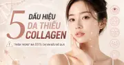 5 dấu hiệu cảnh báo làn da thiếu collagen cần bổ sung ngay