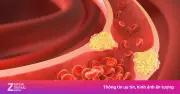 5 dấu hiệu cảnh báo máu trong cơ thể quá đặc, nguy cơ đột quỵ
