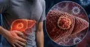 5 dấu hiệu ung thư gan dễ nhầm với tăng cân, đầy hơi