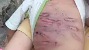 Bé 4 tháng tuổi bị bạo hành đến nguy kịch, người mẹ và bạn trai bị khởi tố