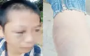 Bé trai 12 tuổi bị bố và mẹ kế đánh đập, công an vào cuộc