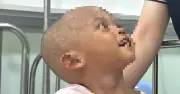 Bé trai 2 tuổi bị bạo hành dã man đã qua cơn nguy kịch