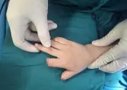 Bé trai 5 tuổi bị đứt lìa ngón tay khi chơi xe điện tự chế