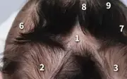 Bé trai có 9 xoáy tóc gây xôn xao mạng xã hội Trung Quốc