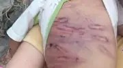Bộ Y tế yêu cầu tăng cường phòng chống bạo lực trẻ em