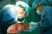 Bệnh viện Việt Đức thực hiện 21 ca ghép tạng từ 3 người cho chết não