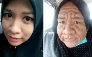 Cô gái 28 tuổi bỗng già như bà lão sau khi mang thai