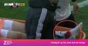 Chấn thương ghê rợn của Anton Stach khiến tuyển Đức lo lắng trước World Cup 2026