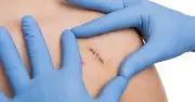 Kiểm soát môi trường vết thương: Chìa khóa cho kết quả thẩm mỹ tối ưu