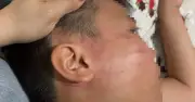 Mẹ tố con trai bị thầy giáo Ấn Độ tát sưng mặt khi học thêm