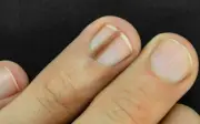 Móng tay - 'tấm gương' phản ánh sức khỏe bạn không nên bỏ qua