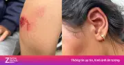 Nữ sinh lớp 6 bị đánh hội đồng, bắt quỳ dưới nắng và lau chân ở Đắk Lắk