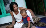 Người cây Indonesia: Từ vết xước đầu gối đến bi kịch cuộc đời