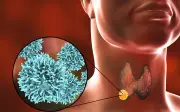 Người đàn ông 43 tuổi phát hiện ung thư tuyến giáp từ dấu hiệu nhiều người Việt bỏ qua
