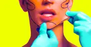 Ảnh AI thúc đẩy kỳ vọng phẫu thuật thẩm mỹ phi thực tế, bác sĩ bất lực