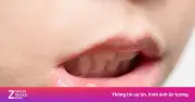 Nhiều người có hàm răng xấu mà không biết nguyên nhân từ đâu