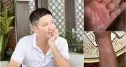 NSƯT Chí Trung mắc bệnh lạ mất ngủ triền miên