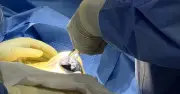 Phát hiện 'u gạc' trong ngực sau 4 năm nâng ngực gây đau vai trái