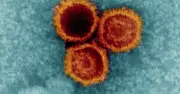 Phát triển kháng thể mới chống virus Epstein-Barr hiệu quả