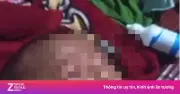 Vụ em bé bị cha ngược đãi ở Cần Thơ: Công an đã tiếp nhận vụ việc
