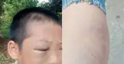 Xác minh clip bé trai mặt bầm tím nghi nhiều lần bị bạo hành