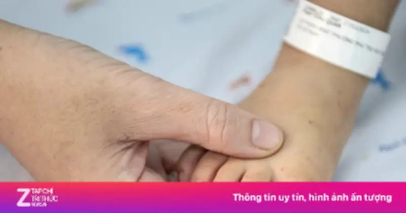 Bé gái 23 tháng tuổi nguy kịch vì tay chân miệng độ IV, suy hô hấp phải lọc máu