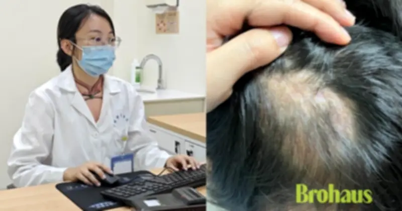 Bé gái 5 tuổi bị hói vĩnh viễn vì ôm thỏ: Cảnh báo cha mẹ